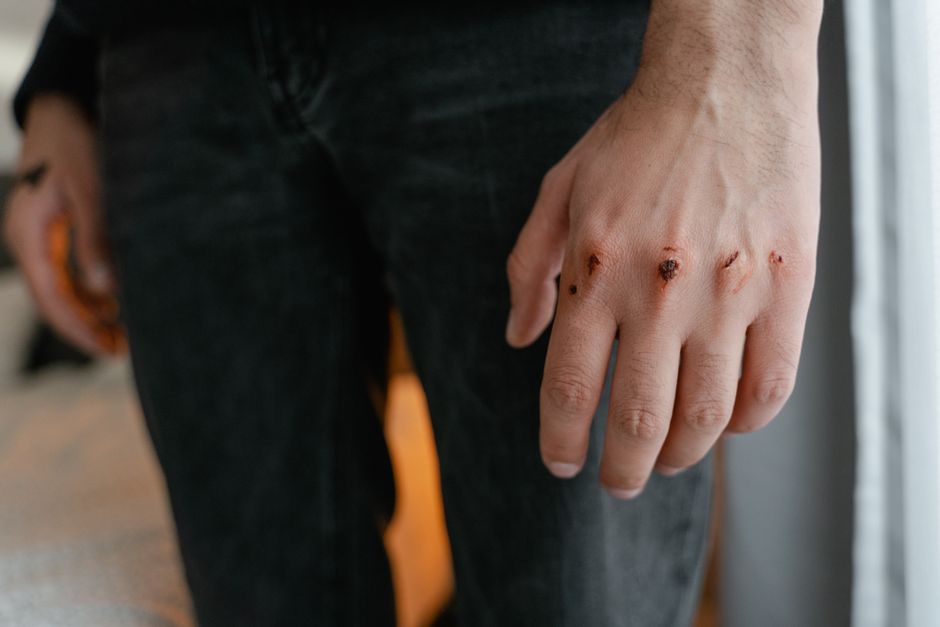 Paper cut pain