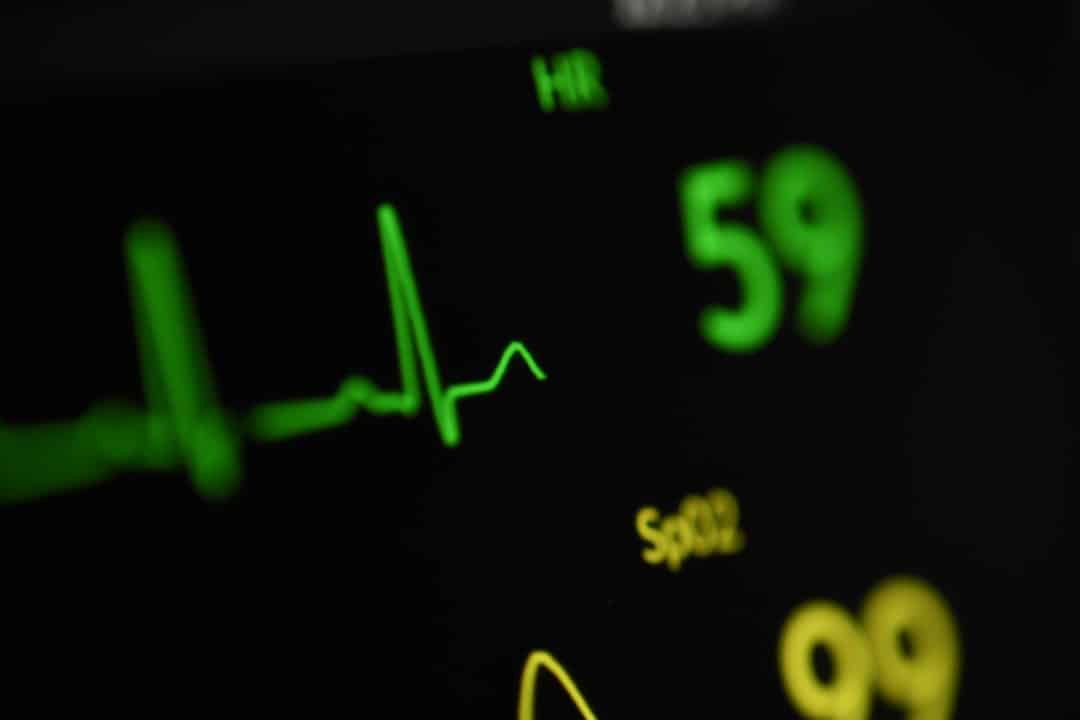 Heart rate spike at exercise onset